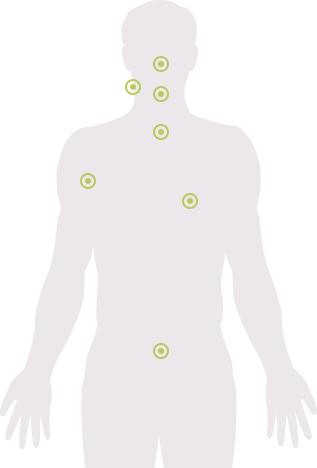 PI is an immune system disorder